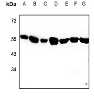 1 - Anti-Alpha-tubulin 3C/D/E Antibody AP53748