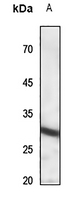 1 - Anti-IL-22RA2 Antibody AP53750