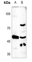 1 - Anti-CLEC14A Antibody AP53752