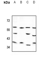 1 - Anti-Cytochrome P450 4Z1/2 Antibody AP53754