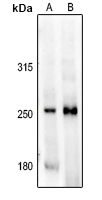 1 - Anti-MAST4 Antibody AP53756