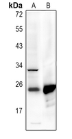 1 - Anti-p22 phox Antibody AP53757