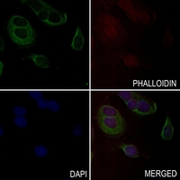 3 - Anti-MYBPC2 Antibody AP53760