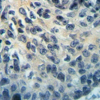 19 - Anti-MYBPC2 Antibody AP53760