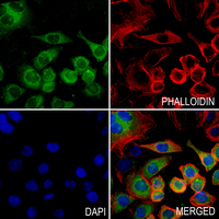 3 - Anti-Cav3.1 Antibody AP53765