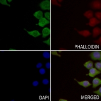 3 - Anti-INPP5E Antibody AP53773