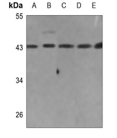1 - Anti-Collagen 26 alpha 1 Antibody AP53776