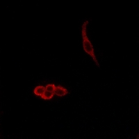 3 - Anti-Delta-NaCH Antibody AP53779