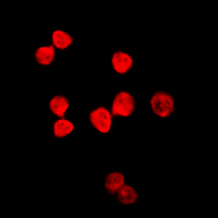 3 - Anti-Thymine DNA Glycosylase Antibody AP53780