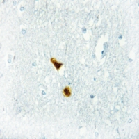 19 - Anti-Thymine DNA Glycosylase Antibody AP53780