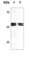 1 - Anti-Thymine DNA Glycosylase Antibody AP53780