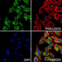 3 - Anti-PLA2G4C Antibody AP53782