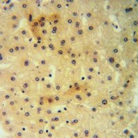 19 - Anti-PLA2G4C Antibody AP53782