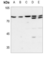 1 - Anti-PLA2G4C Antibody AP53782