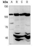 1 - Anti-CARD14 Antibody AP53785