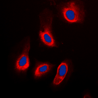 3 - Anti-ADPGK Antibody AP53786