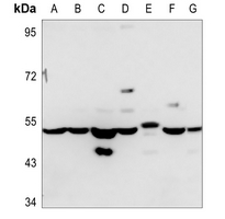 1 - Anti-ADPGK Antibody AP53786