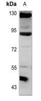 1 - Anti-ANKRD20A3 Antibody AP53791