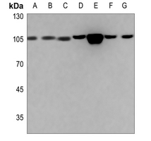 1 - Anti-ACTN1/2/3/4 Antibody AP53792