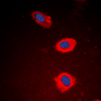 3 - Anti-NT5C1B Antibody AP53793
