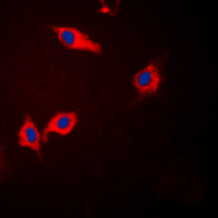 3 - Anti-CK1 alpha Antibody AP53794