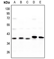 1 - Anti-CK1 alpha Antibody AP53794