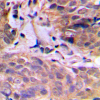 19 - Anti-HuB Antibody AP53795