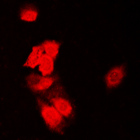 3 - Anti-SIAH1/2 Antibody AP53797