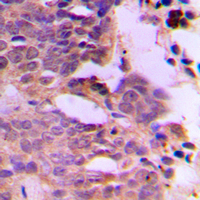 19 - Anti-SIAH1/2 Antibody AP53797