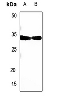 1 - Anti-SIAH1/2 Antibody AP53797