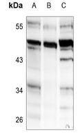 1 - Anti-AChE Q Antibody AP53799