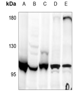1 - Anti-Apolipoprotein B Receptor Antibody AP53800