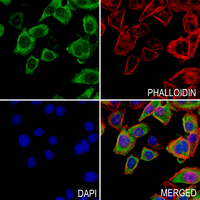 3 - Anti-ARHGAP20 Antibody AP53801