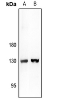 1 - Anti-ARHGAP20 Antibody AP53801