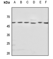 1 - Anti-Beta-tubulin Antibody AP53802