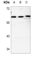 1 - Anti-Cadherin 23 Antibody AP53803