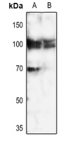 1 - Anti-Calpain 3 Antibody AP53804