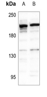 1 - Anti-Carboxypeptidase D Antibody AP53805
