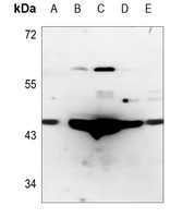 1 - Anti-CTH Antibody AP53807