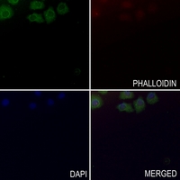 3 - Anti-CYFIP1 Antibody [KO/KD Validated] AP53808