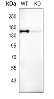 0 - Anti-CYFIP1 Antibody [KO/KD Validated] AP53808