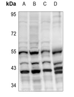 1 - Anti-Cytochrome P450 27C1 Antibody AP53809