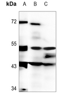 1 - Anti-DMRTA1 Antibody AP53810