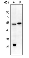 1 - Anti-EPX HC Antibody AP53812