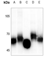 1 - Anti-GGT5 HC Antibody AP53815