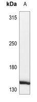 1 - Anti-HCAP (Phospho-S1083) Antibody AP53817