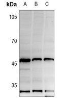 1 - Anti-HLA-A/B/C Antibody AP53818