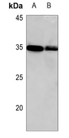 1 - Anti-HOXC8 Antibody AP53820