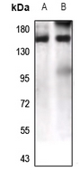 1 - Anti-LPHN1 Antibody AP53821