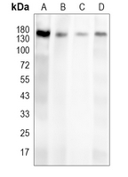 1 - Anti-LPHN2 Antibody AP53822